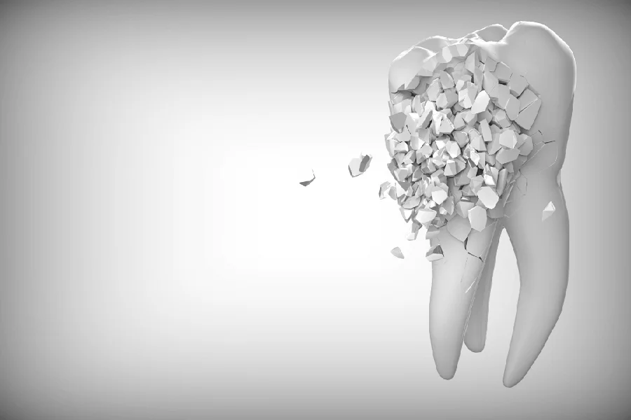 A tooth with a broken tooth on it, indicating dental damage or decay